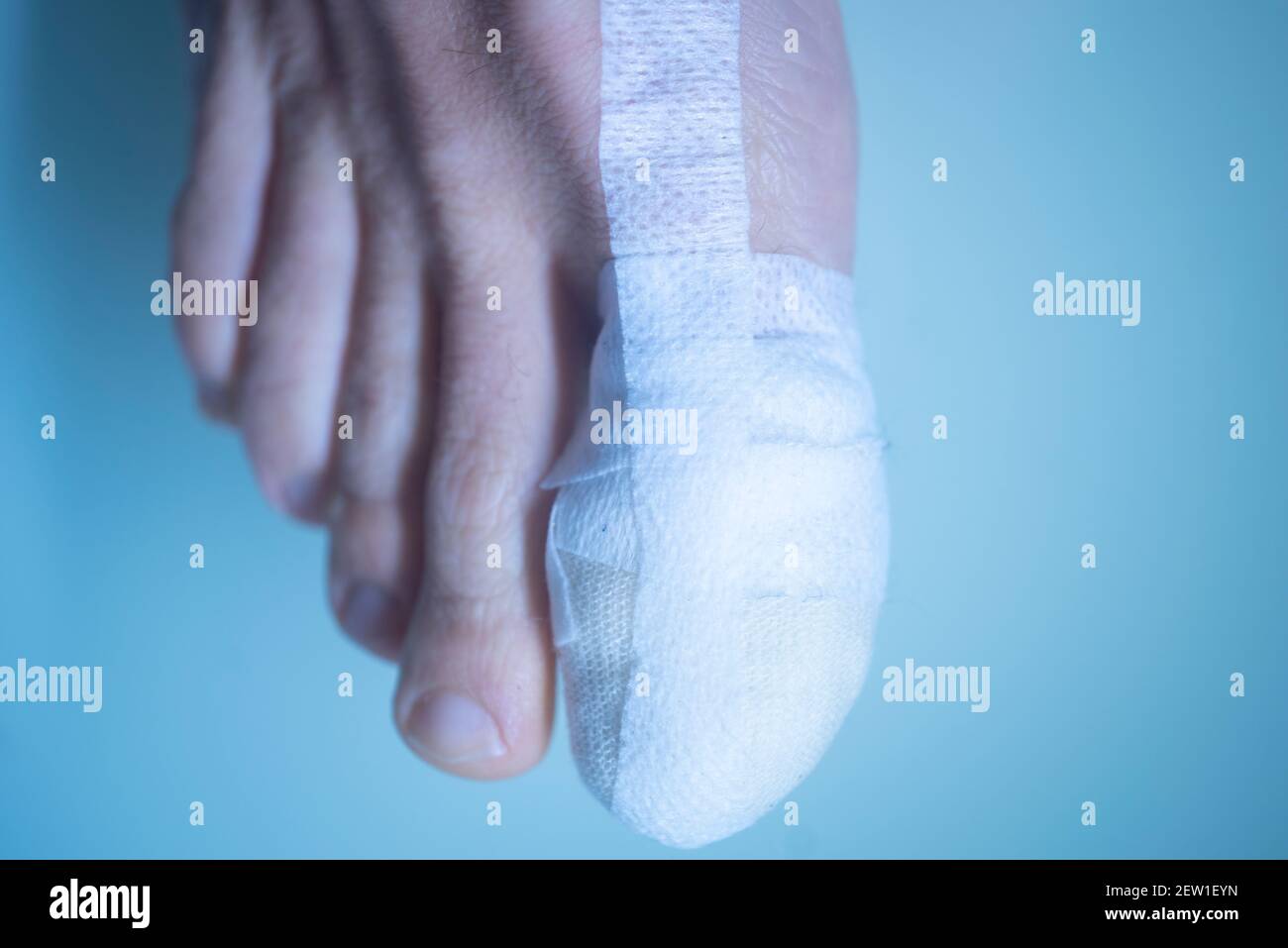 Foot big toe bandage injured feet in medical clinic hospital center
