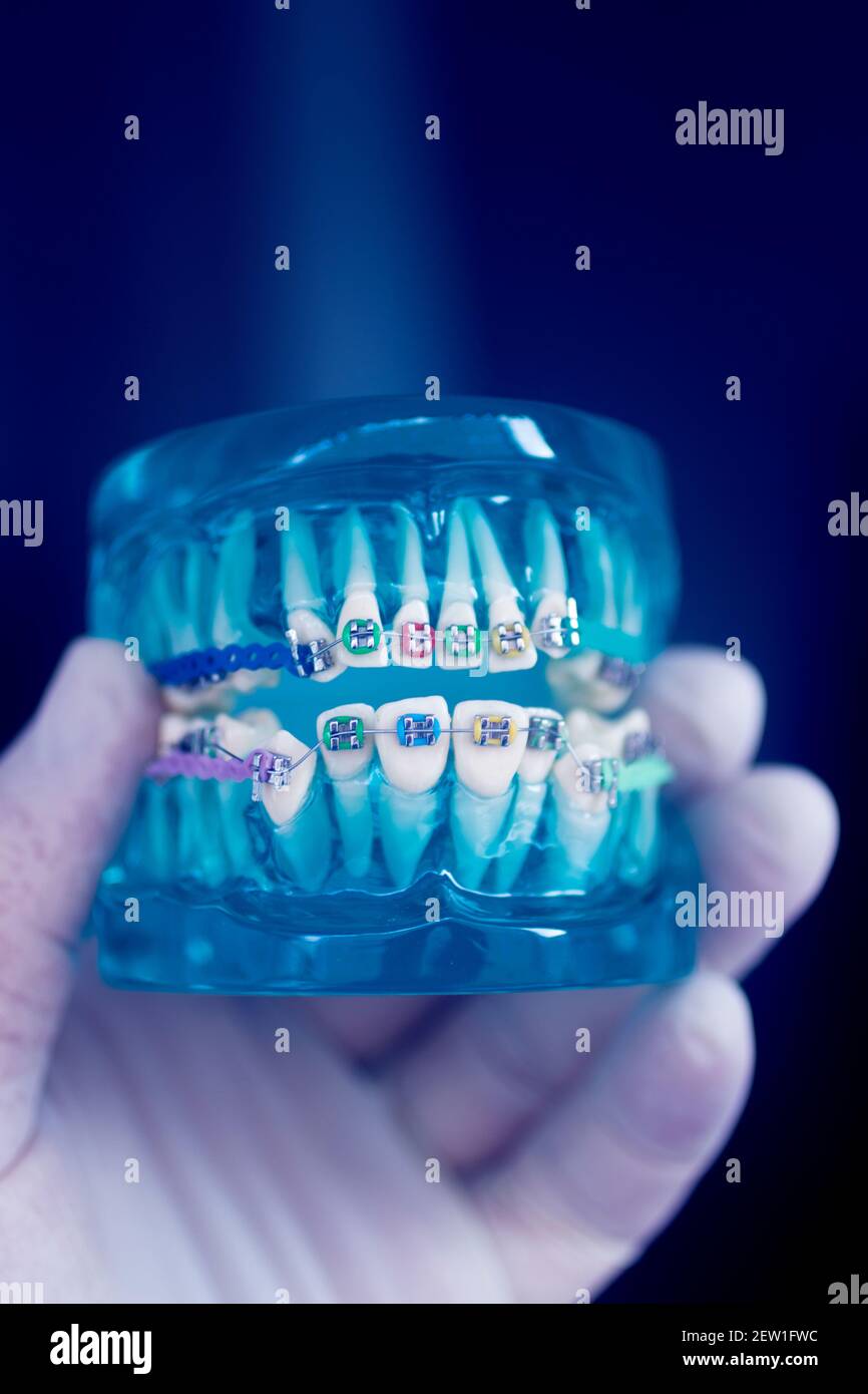 Dental teeth aligner bracket teaching student model showing gums and