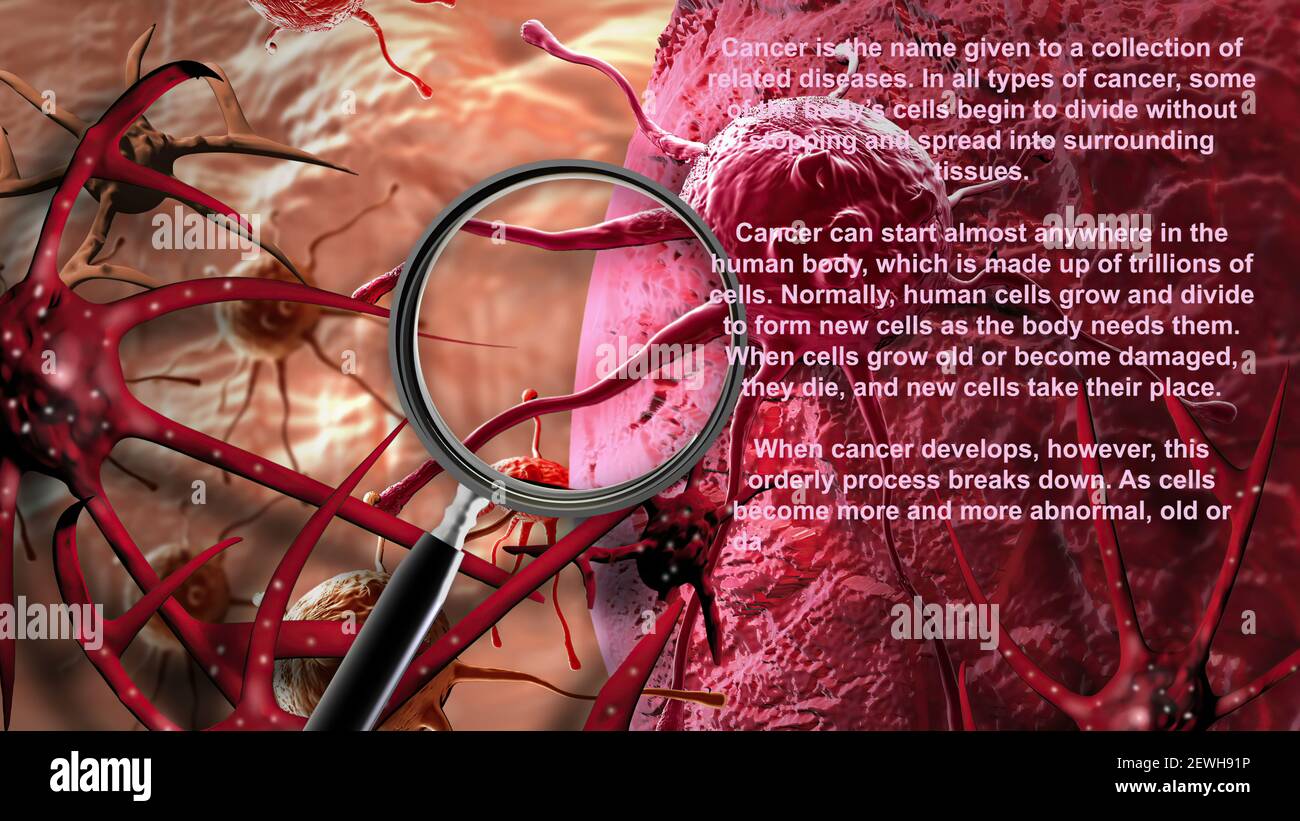 3D illustration - Concept of Cancer Cell in human body Stock Photo - Alamy