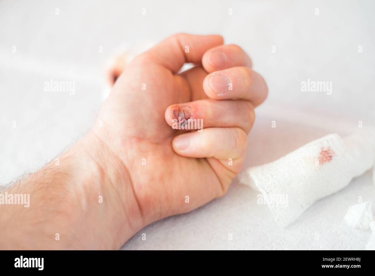 KATOWICE, POLAND - Mar 03, 2021: A hand with a broken and split stitched finger rests on a white surgical table Stock Photo