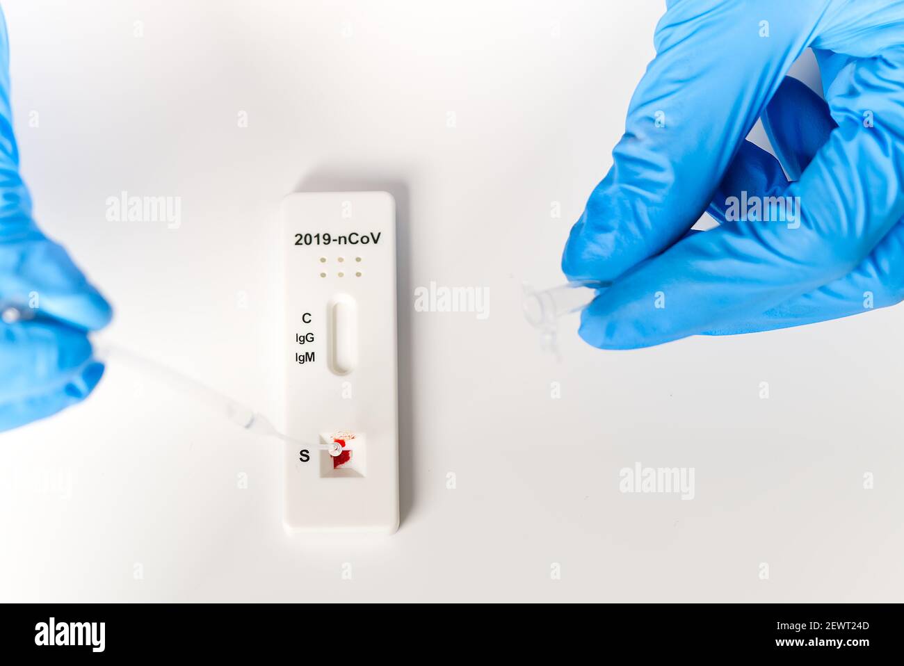 Covid rapid test. Negative test result by using rapid test device for COVID-19 coronavirus Stock Photo