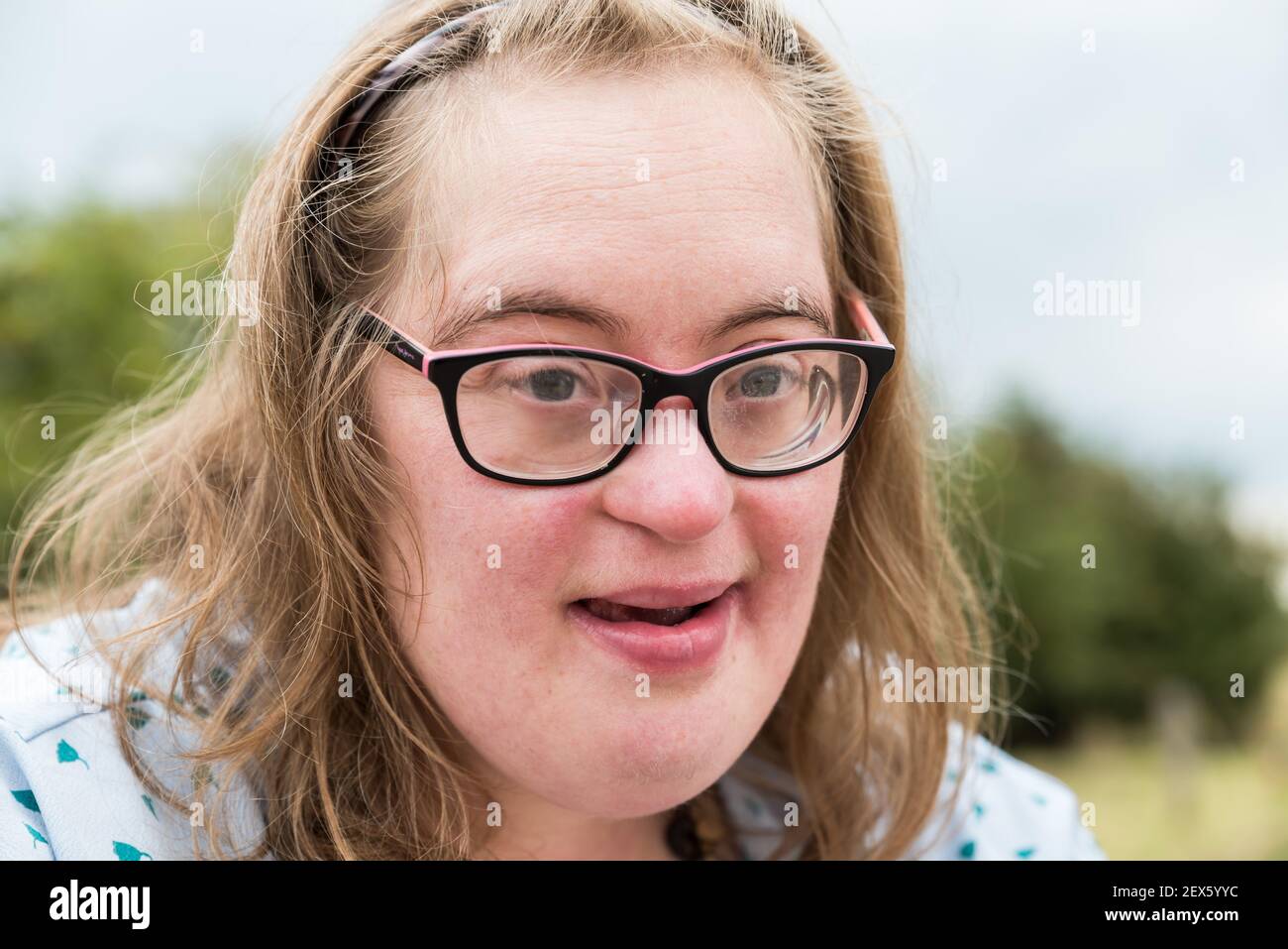 Portrait of a happy Down Syndrome woman of 37 years old Stock Photo