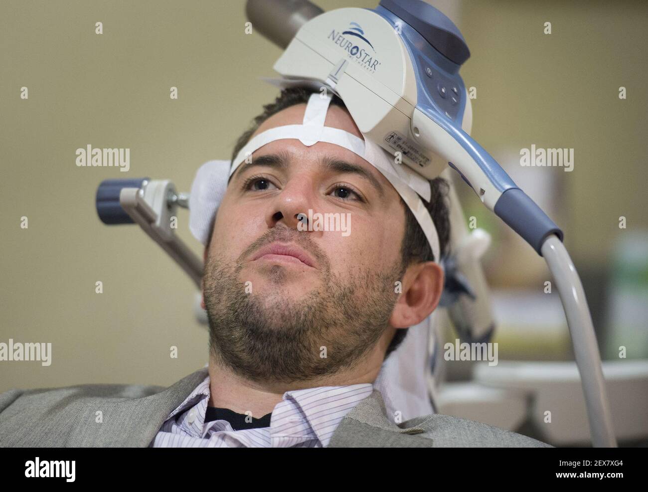 31-year-old Nicholas O'Madden, who suffers from anxiety and depression, receives treatment with Transcranial Magnetic Stimulation (TMS) therapy, which uses a large magnet to stimulate certain parts of the brain to alleviate depressive symptoms at TMS Health Solutions on July 2, 2015 in Sacramento, Calif. (Photo by Randy Pench/Sacramento Bee/TNS) *** Please Use Credit from Credit Field *** Stock Photo