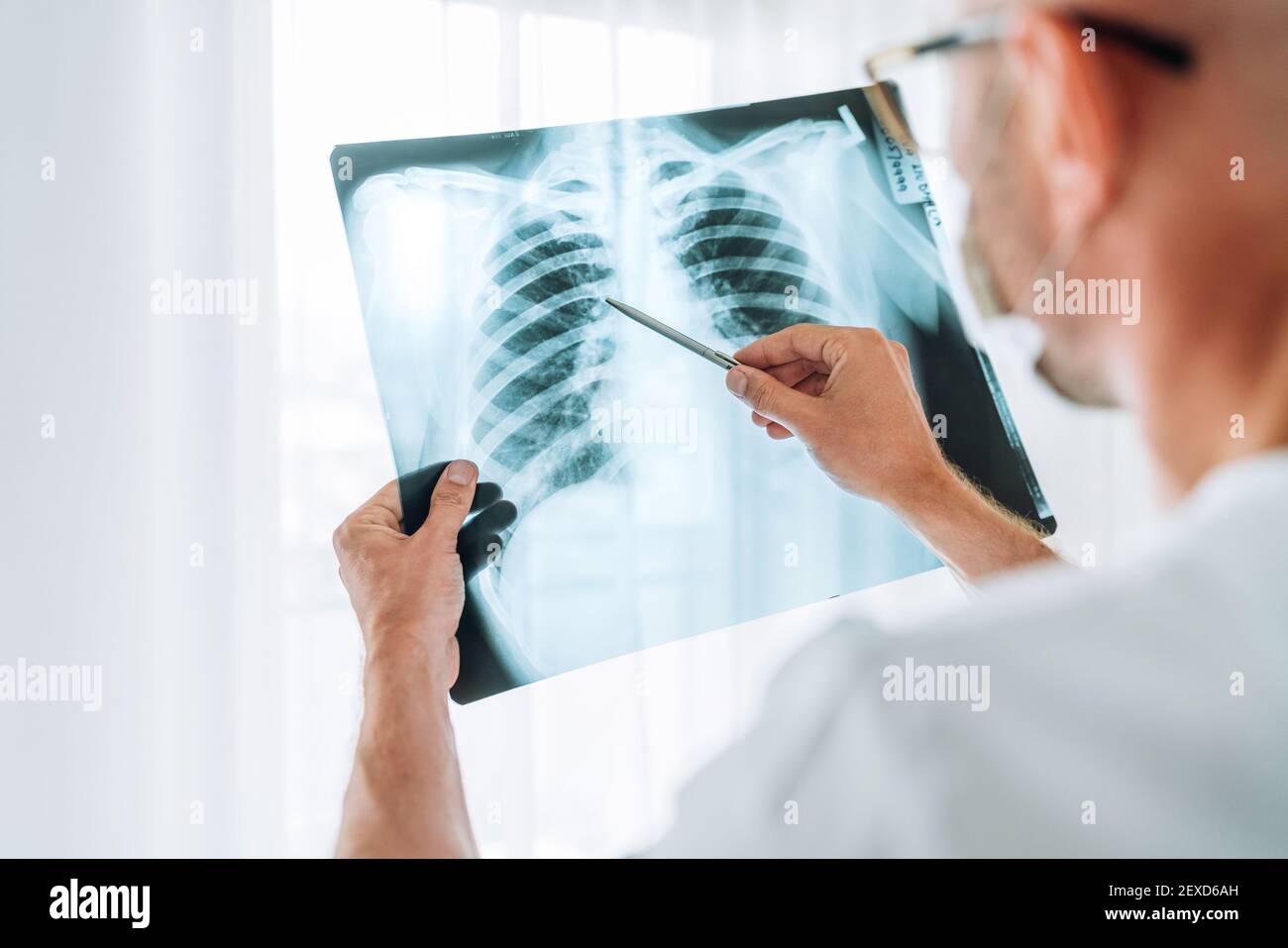 Male doctor examining the patient chest xray film lungs scan at