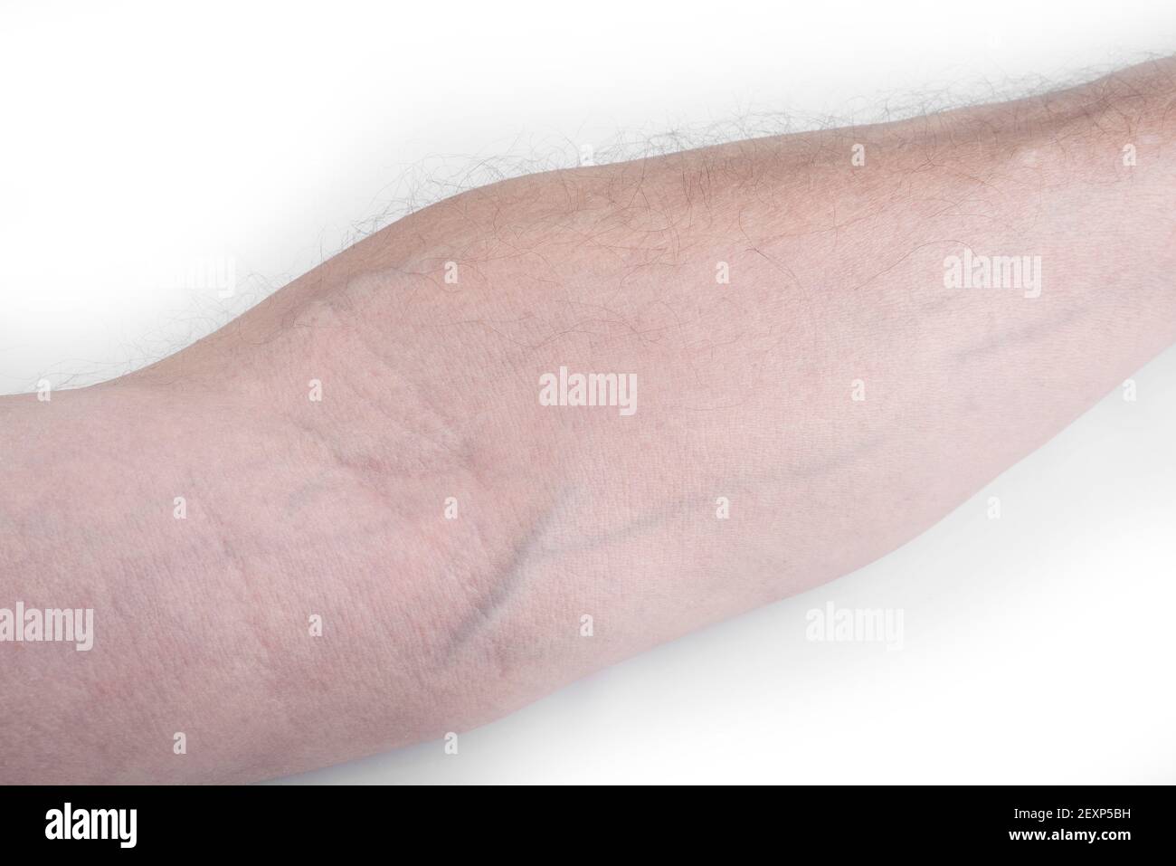 Veins arm hires stock photography and images Alamy