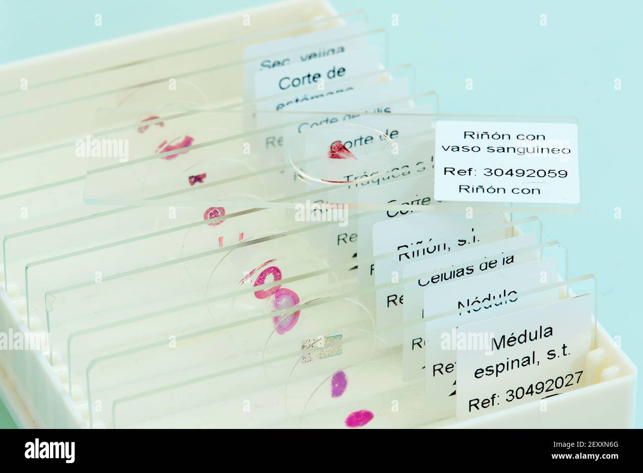 Slides with tissue samples in a medical laboratory. Basque Country, Spain, Europe. Stock Photo