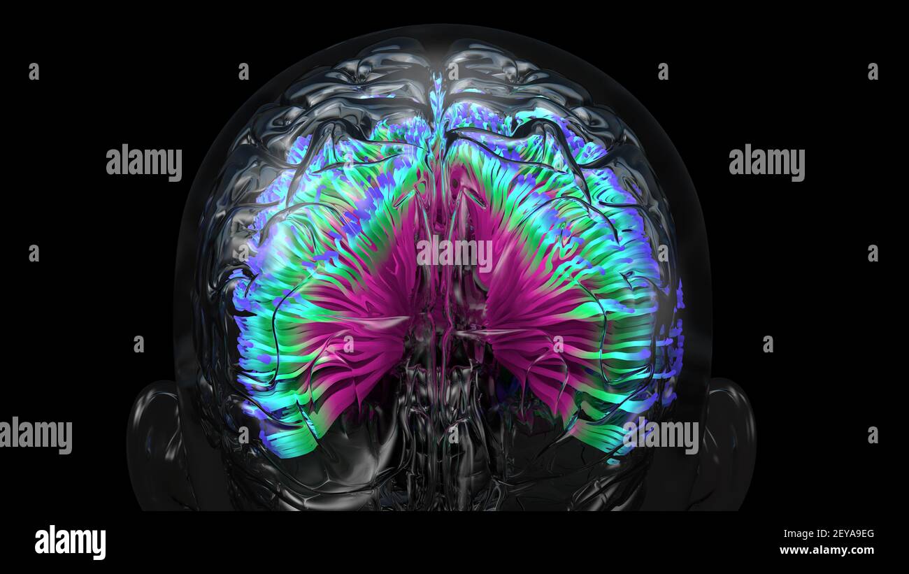 Brain infection, conceptual illustration Stock Photo - Alamy