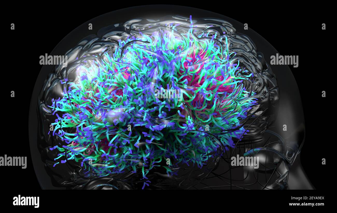 Brain infection, conceptual illustration Stock Photo - Alamy