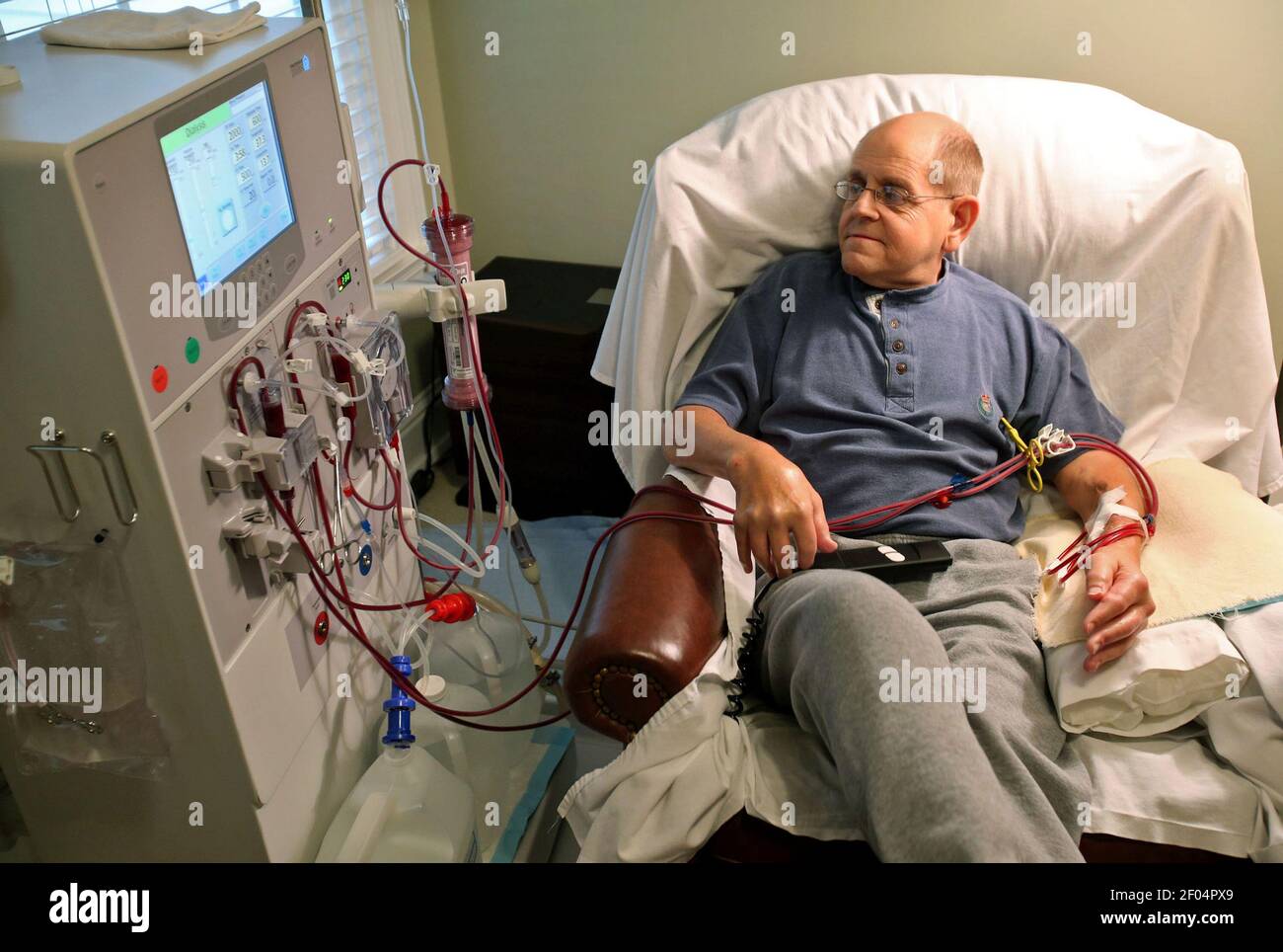 Renal dysplasia hires stock photography and images Alamy