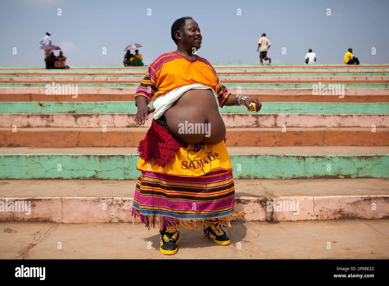 african obesity, anti-obesity, bariatric surgery, belly, big, big belly, bm...