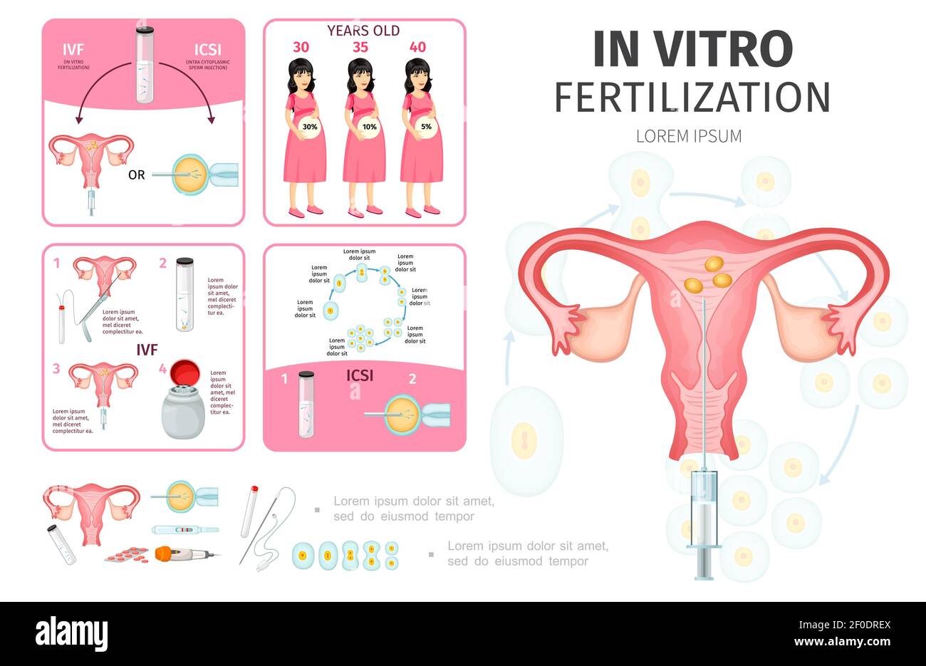 Flat in vitro fertilization infographic concept with pregnant woman