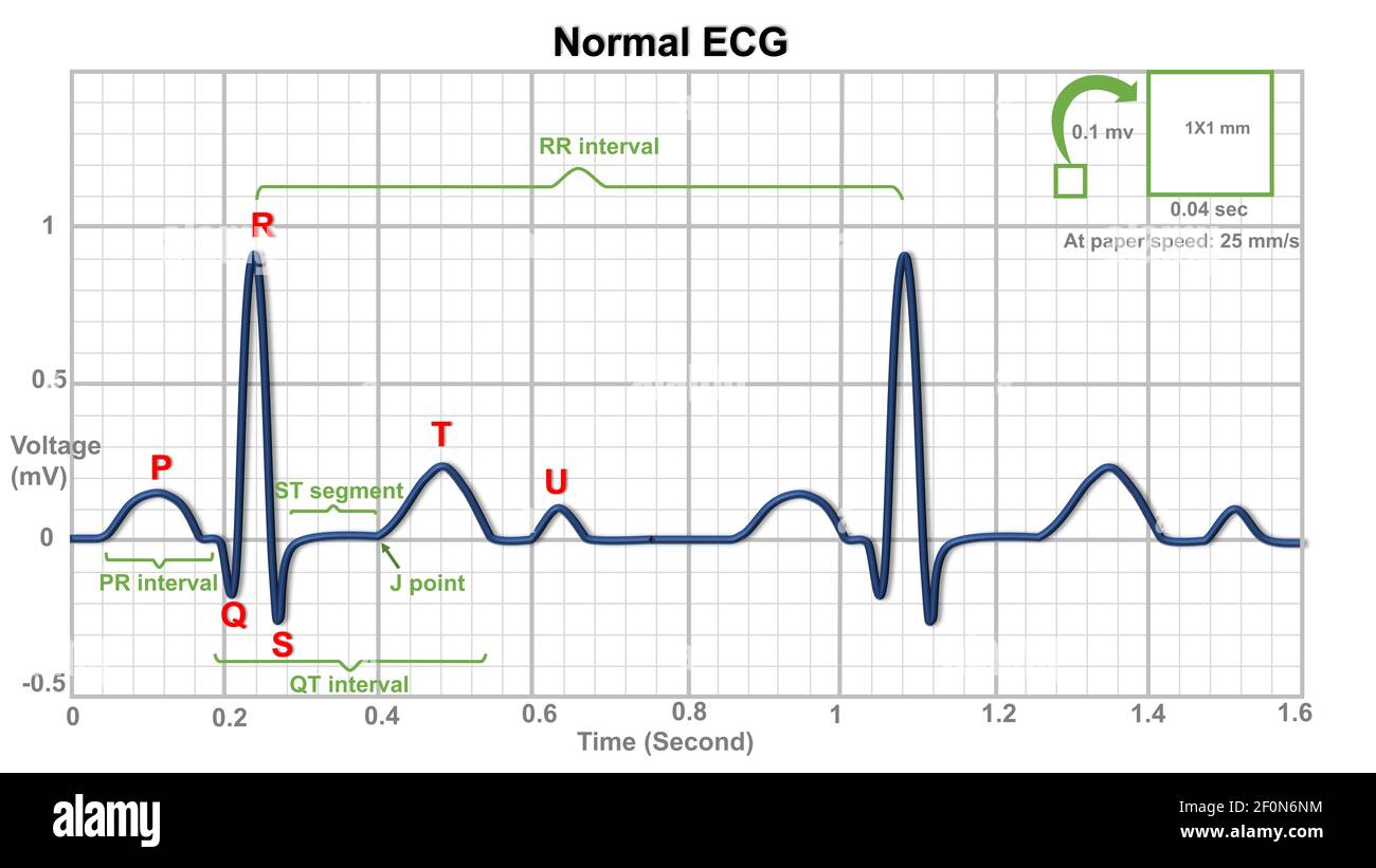 Normal electrocardiogram with waves, segments and intervals Stock Photo