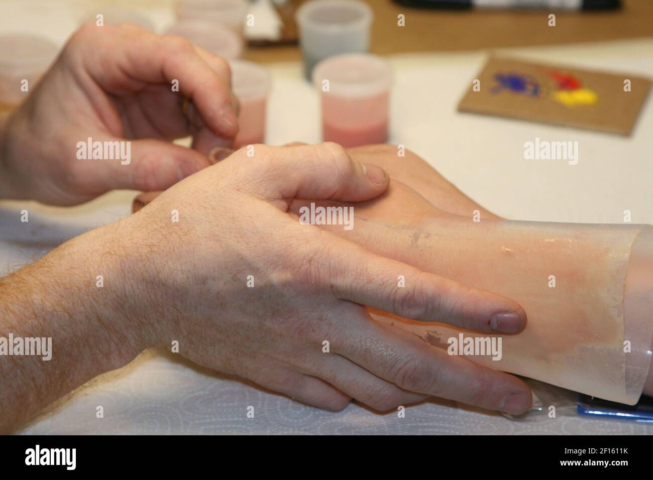 A technician at Walter Reed Army Medical Center works to create a new ...