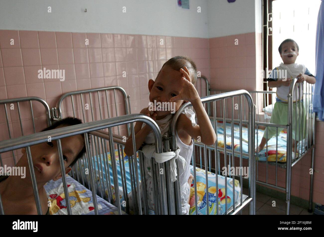 Abandoned Children Suffering From Agent Orange Live At The Lang Hoa Binh Ii Peace Village In Ho Chi Minh City Vietnam Photo By Nhat V Meyer San Jose Mercury News Mct Sipa Usa Stock Photo