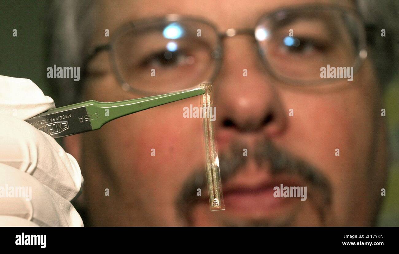Duran Array KRT US NEWS STORY SLUGGED: MED-RETINA KRT PHOTOGRAPH BY DOUG DURAN ...
