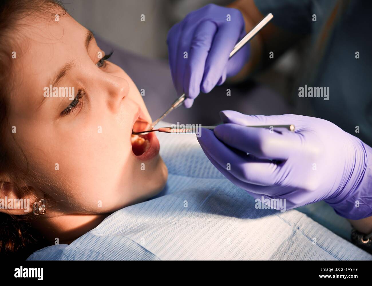 Close up of girl patient with open mouth while dentist checking kid teeth. Stomatologist examining child teeth with dental explorer and mirror. Concept of pediatric dentistry and dental care. Stock Photo