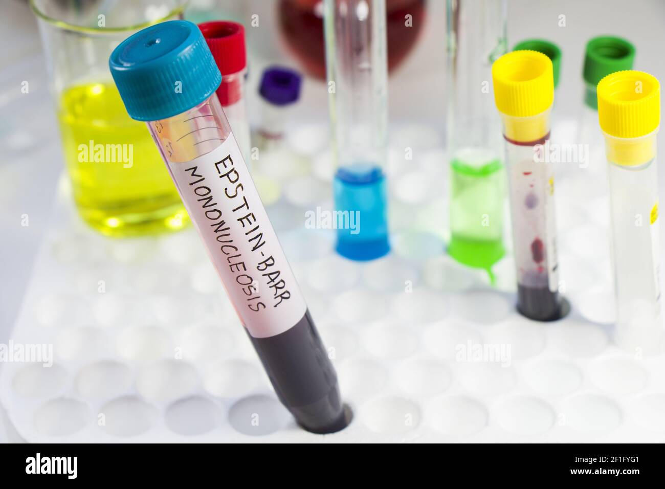 A closeup of an EPSTEINBARR virus test tube on the table in the