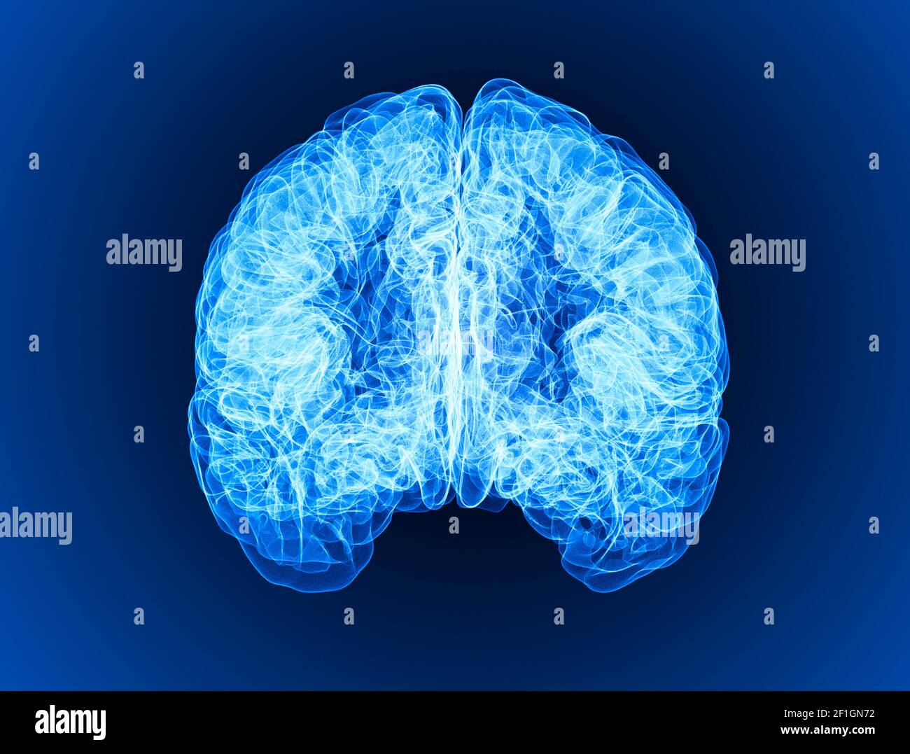 Pain in the head, brain and synapses, cognitive problems, mental deficit. Aneurysm. Degenerative diseases affecting the brain area. Parkinson, stroke Stock Photo