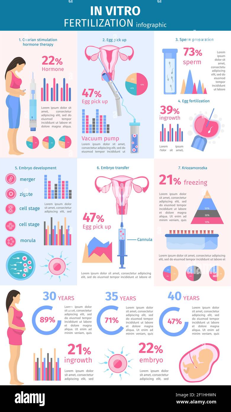 Insemination procedure flat infographic concept with elements and steps of in vitro fertilization process vector illustration Stock Vector
