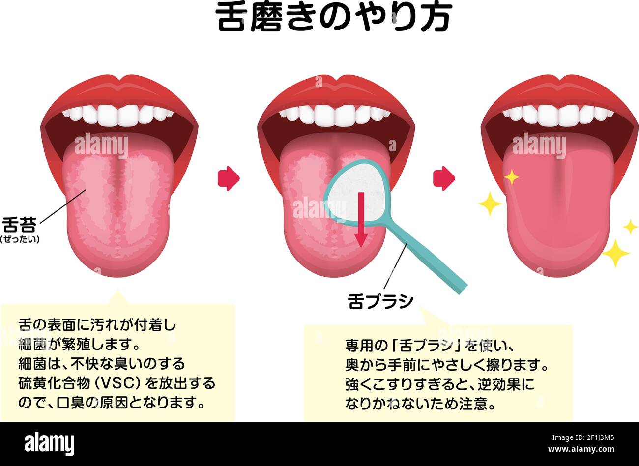 How to clean your tongue vector illustration (Halitosis prevention ...