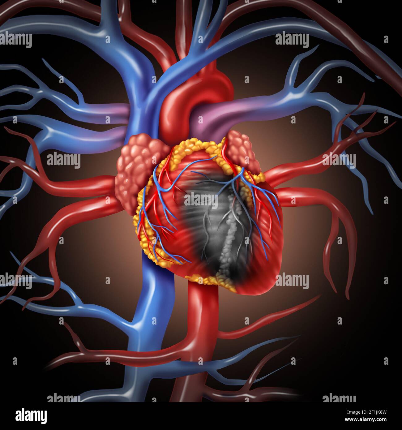 Heart disease anatomy concept and cardiovascular illness from a human organ as a medical health care symbol. Stock Photo