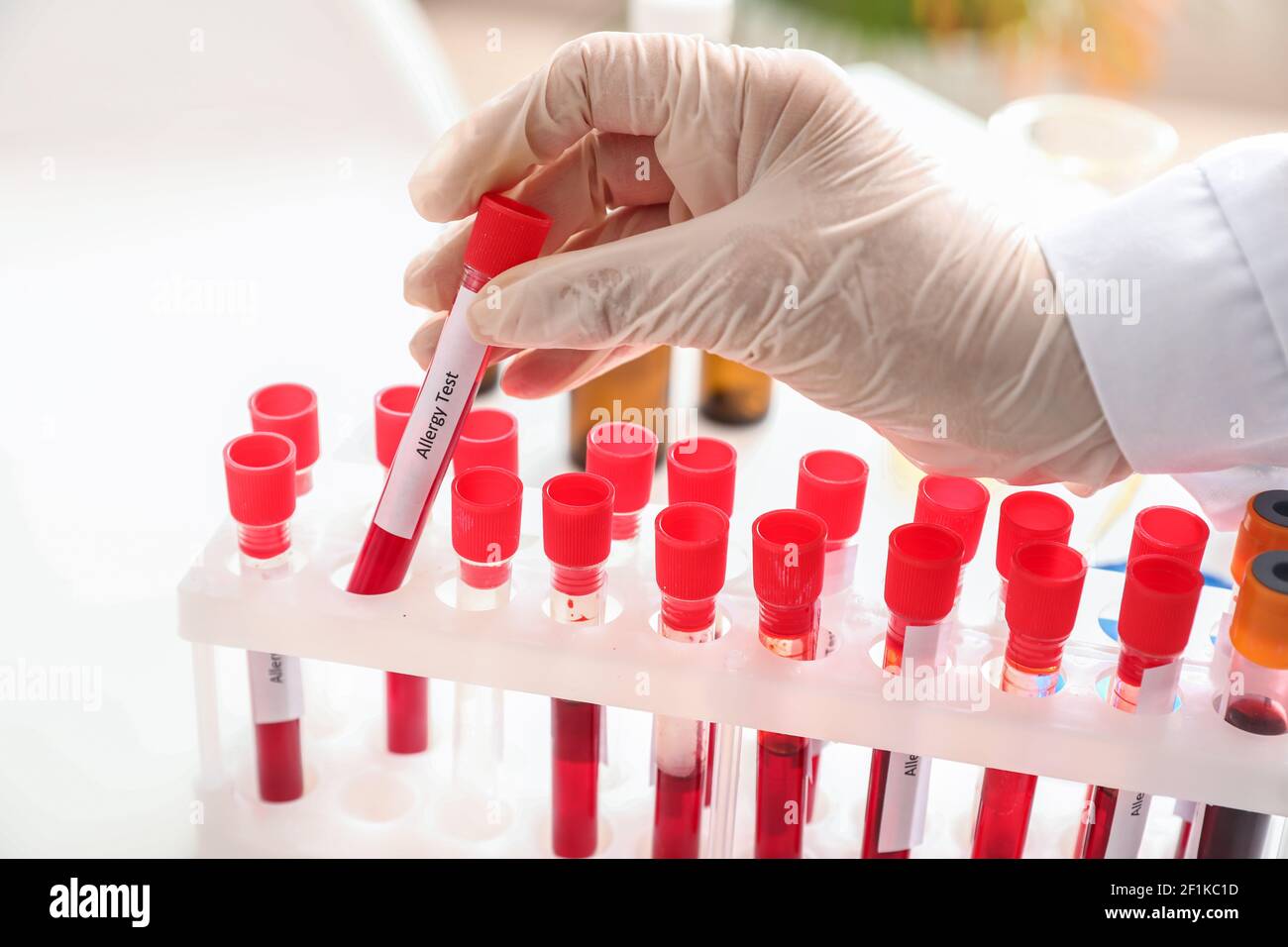 Doctor with allergy test in laboratory Stock Photo - Alamy