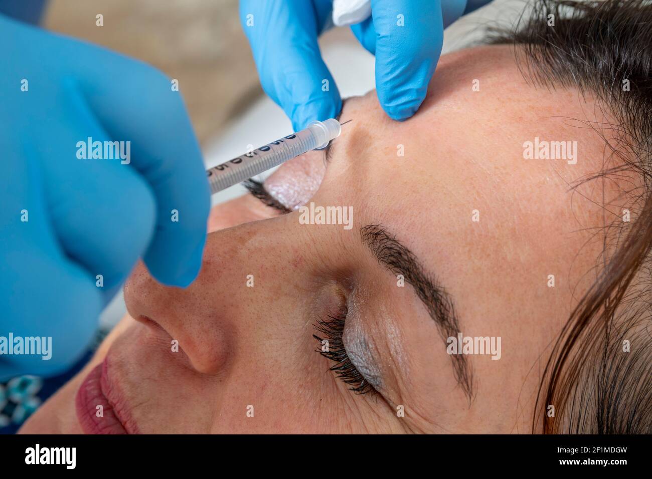 Anti aging, rejuvenating facial treatment concept: Dermatological expert injects liquid anti wrinkle treatment. Professional cure to mid age woman. Stock Photo