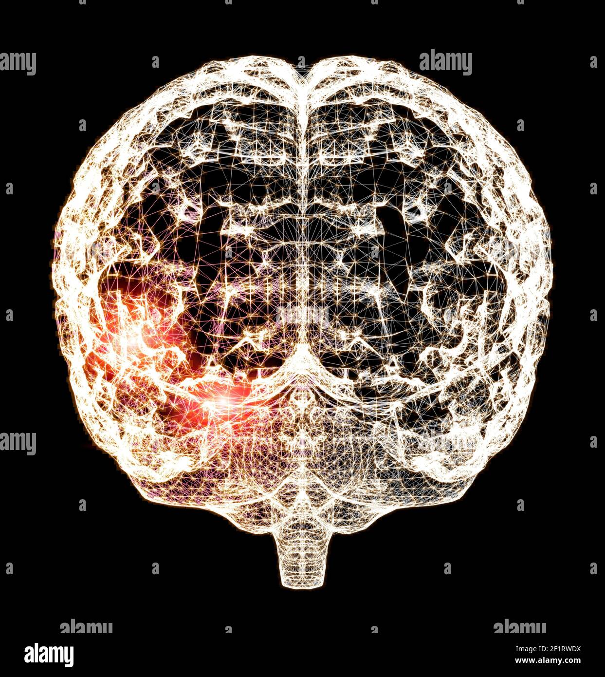 Pain in the head, brain and synapses, cognitive problems, mental deficit. Aneurysm. Degenerative diseases affecting the brain area. Parkinson, stroke Stock Photo