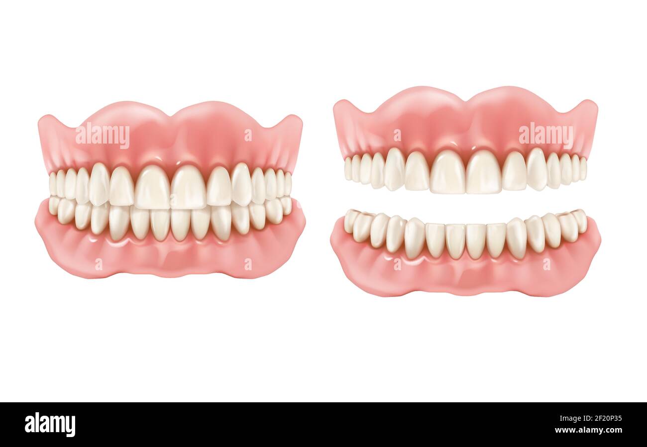 Denture, dental teeth and jaw, realistic prosthesis, vector tooth and