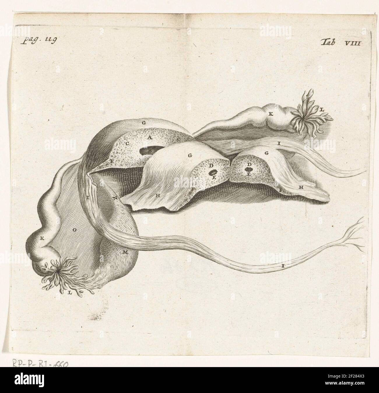 Anatomical depiction of an ectopic pregnancy.In 1672 physician and anatomist Reinier de Graaf published De mulierum organis, a book about the organs of the female body, with prints by Hendrik Bary. De Graaf was the first to conclude that a foetus grows from the mother’s egg cell after it is fertilised by the father’s seed. He also discusses anomalies such as ectopic pregnancies (when the fertilised egg implants outside the womb). Stock Photo