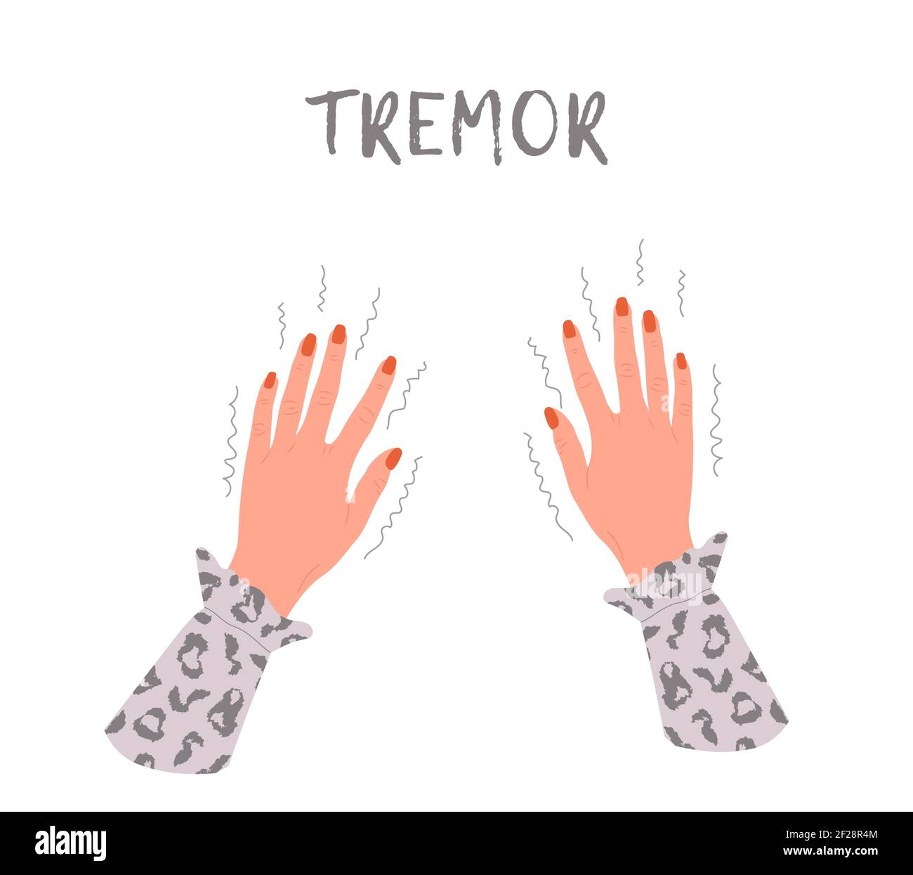 Tremor hands. Parkinson disease. Female arms with nails. Physiological stress symptoms. Vector illustration in flat cartoon style Stock Vector
