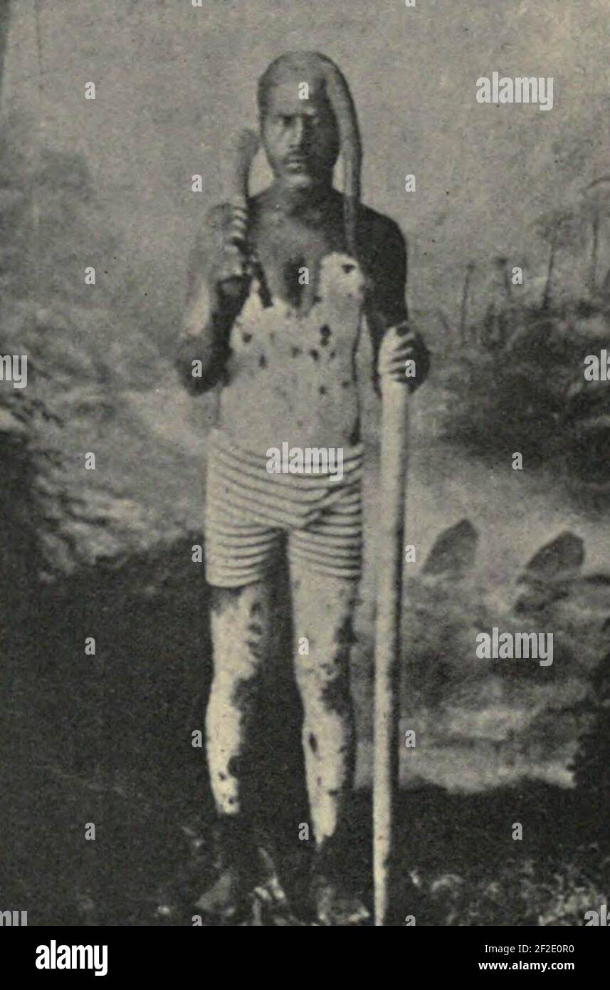 A Loyalty Islander daubed with Lime, spotted paint, Noumea. Stock Photo