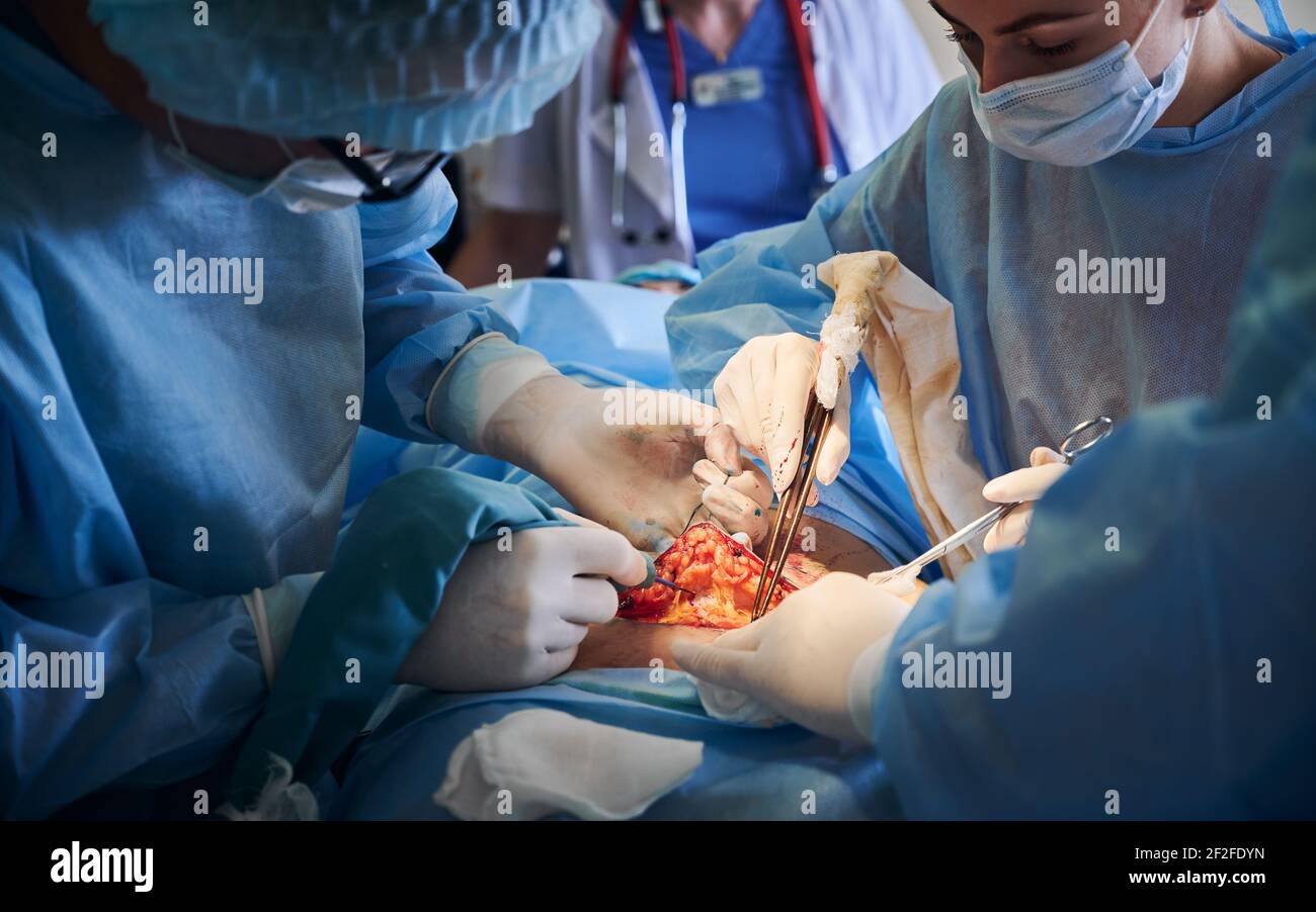 Doctors performing abdominoplasty surgery in operating room. Stock Photo