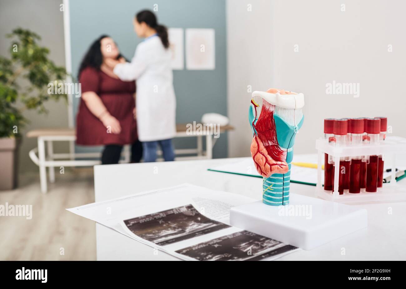 Thyroid anatomical model and thyroid hormone blood test tubes, close-up. doctor probes the neck of a fat woman in background Stock Photo