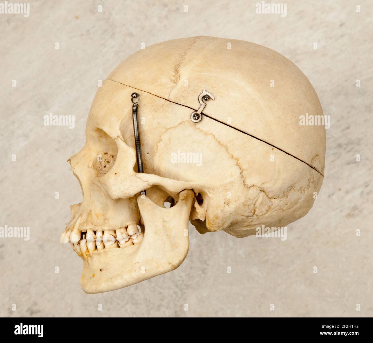 Sideways or profile view of a human skull which has been prepared for medical studies. Stock Photo