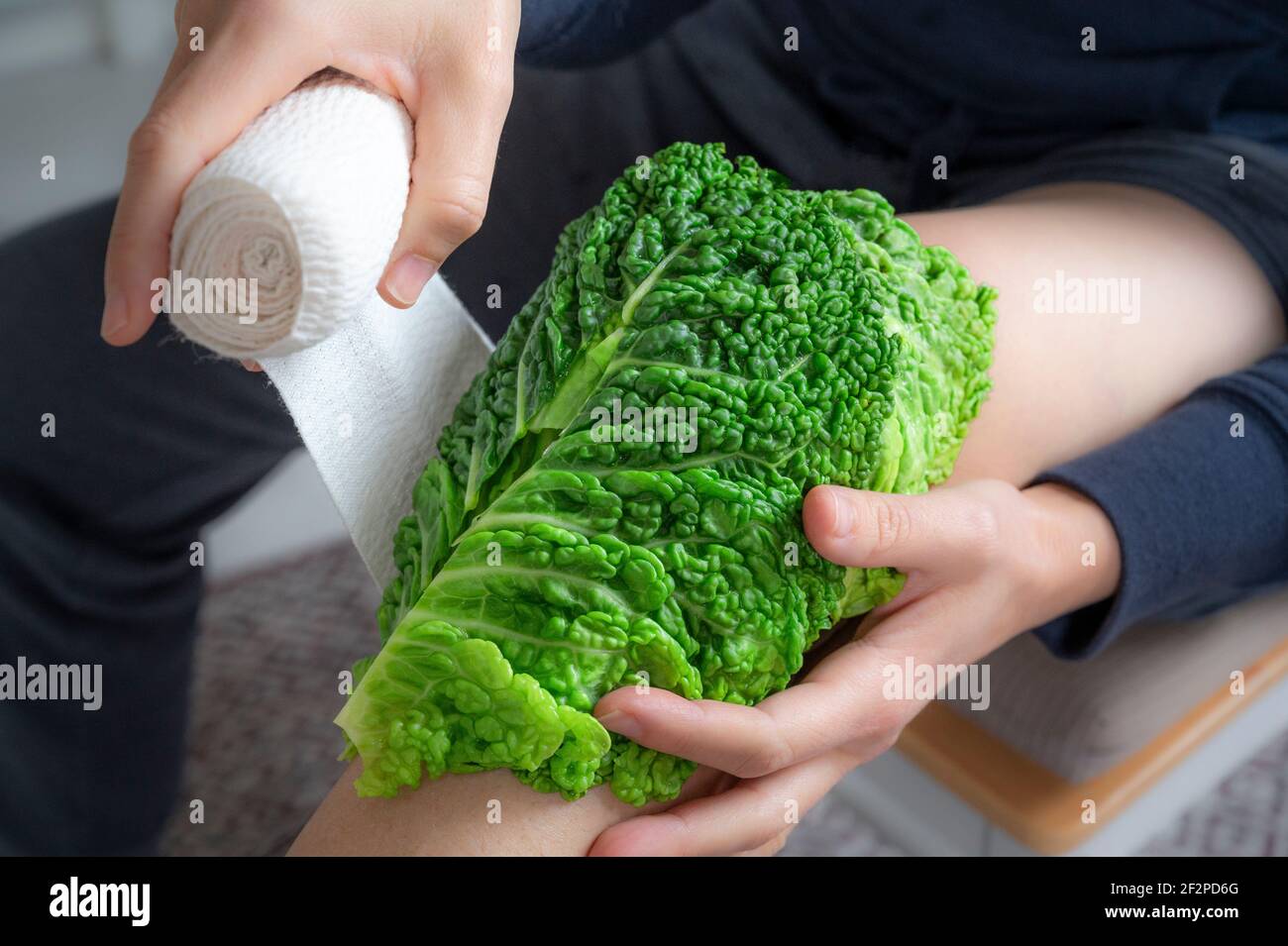 Knee, inflammation, home remedies cabbage wrap, savoy cabbage leaf Stock Photo Alamy
