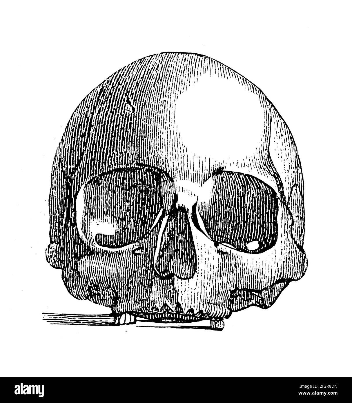 Antique illustration of a skull of a Kotzebue inhabitant. Engraving published in Systematischer Bilder-Atlas zum Conversations-Lexikon, Ikonographisch Stock Photo