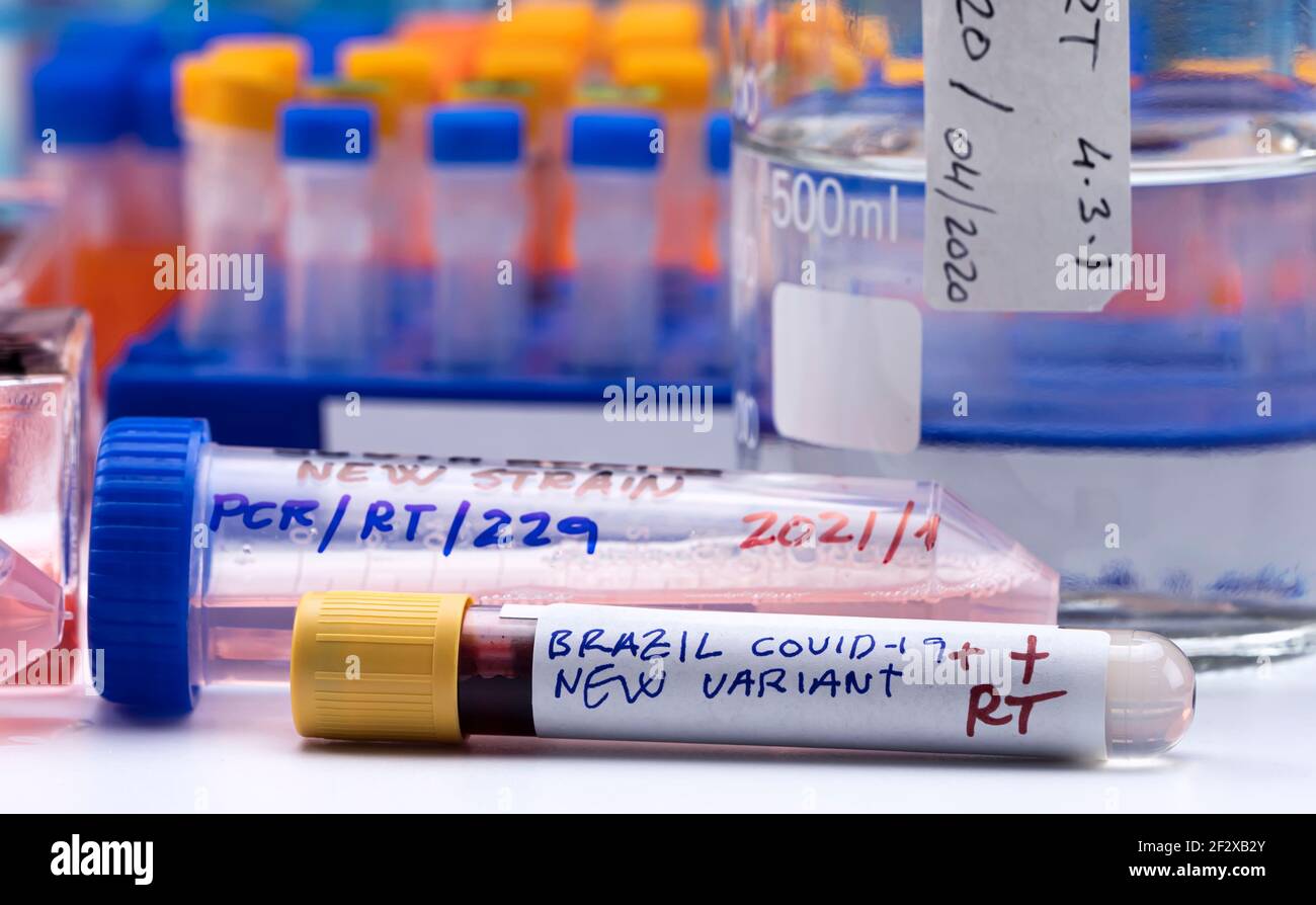 Several vials positive for covid-19 infection of the new variant in the south africa, conceptual image. Stock Photo