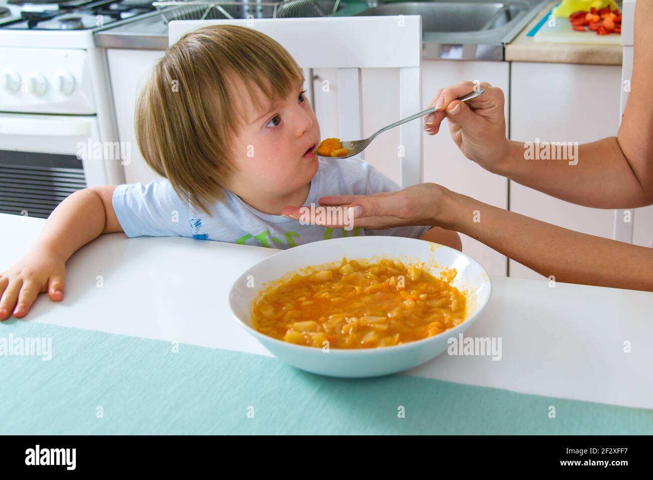 Mom feeding her disabled child with down syndrome with a spoon. Mother giving food to toddler at home. Baby food. Stock Photo