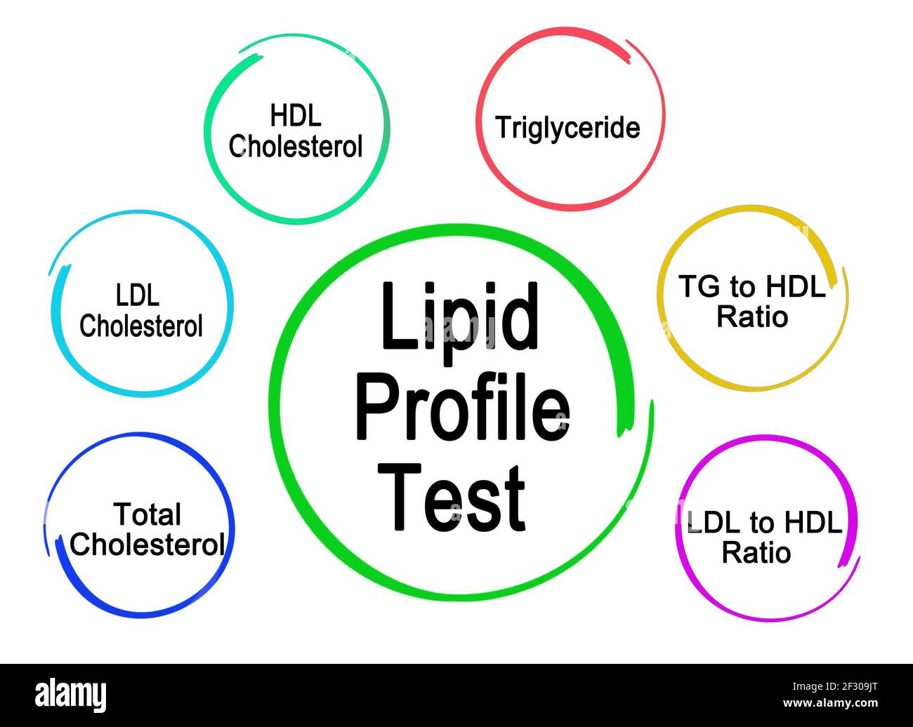 Lipid profile hires stock photography and images Alamy