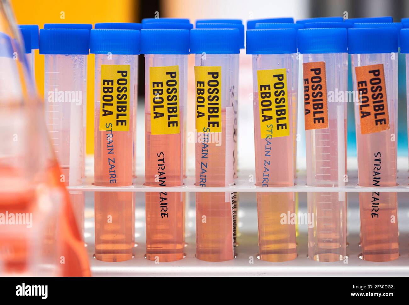 Sample vials of possible Ebola patients infected with new Zaire strain of Ebola, concept image Stock Photo
