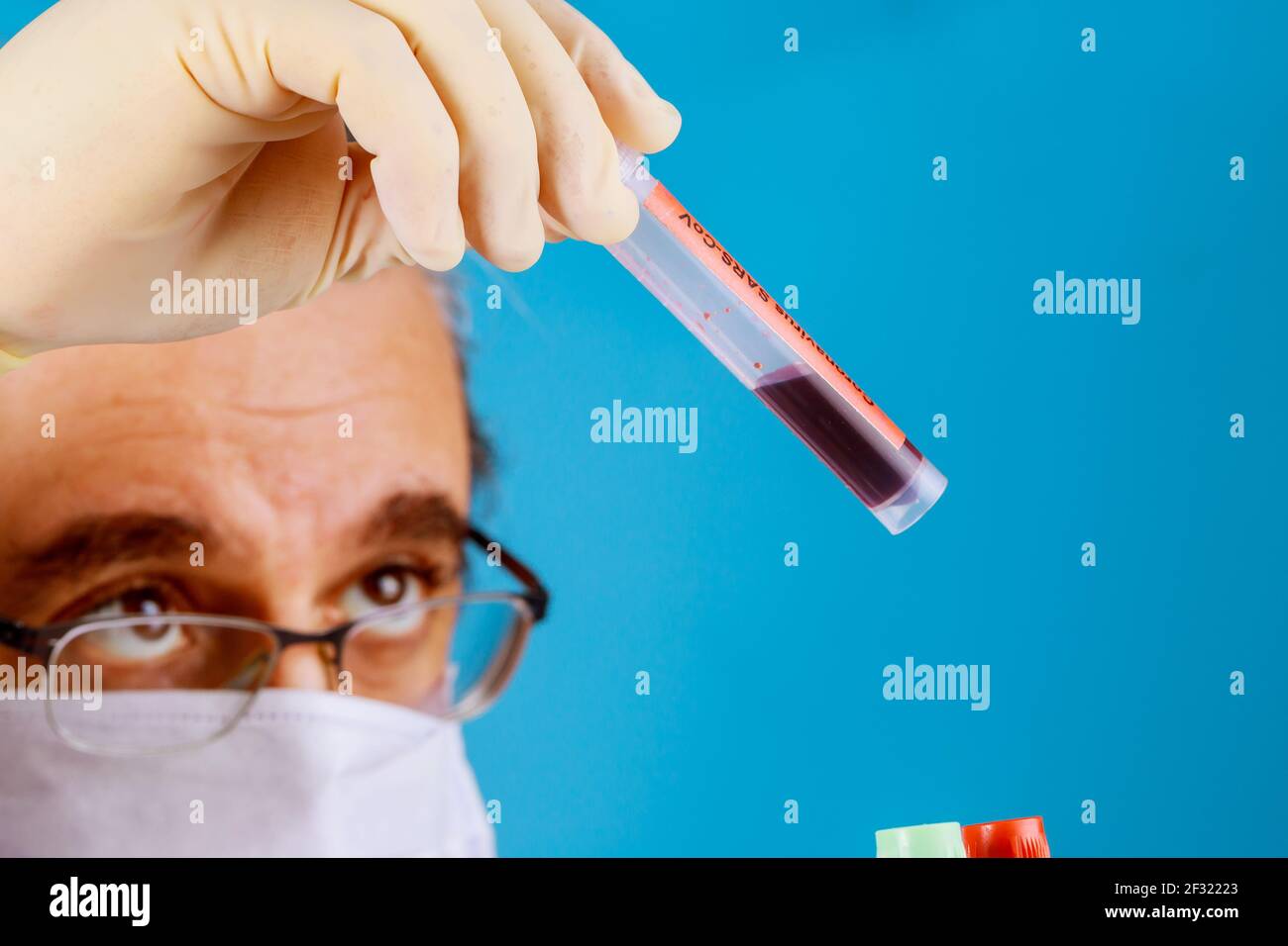Laboratory technician holding a hand with blood sample Stock Photo - Alamy