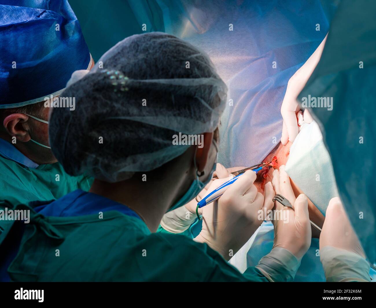 Proctological hi-res stock photography and images - Alamy