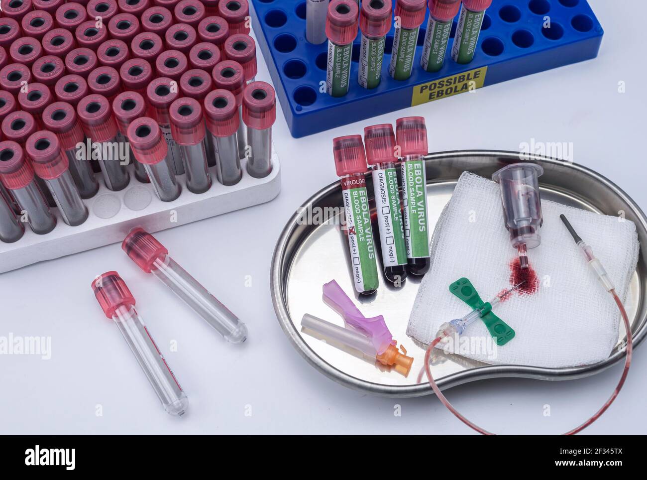 Sample vials of blood from possible Ebola patients infected with new Zaire strain of Ebola, concept image Stock Photo
