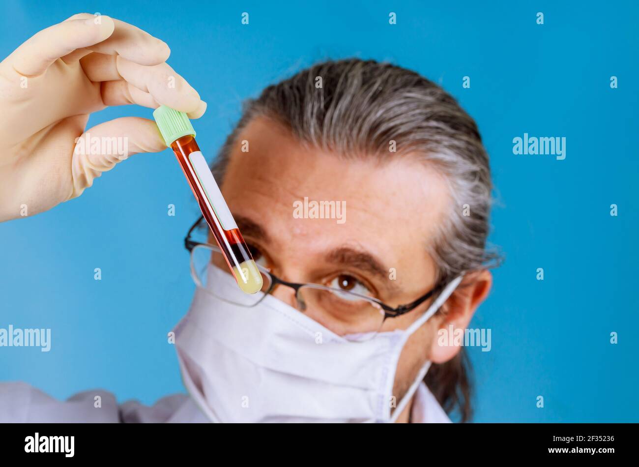 Blood sample screening test on a laboratory Stock Photo Alamy
