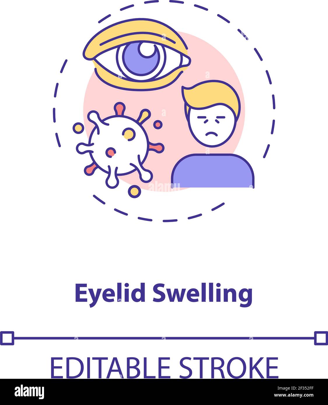 Eyelid swelling concept icon Stock Vector Image & Art - Alamy