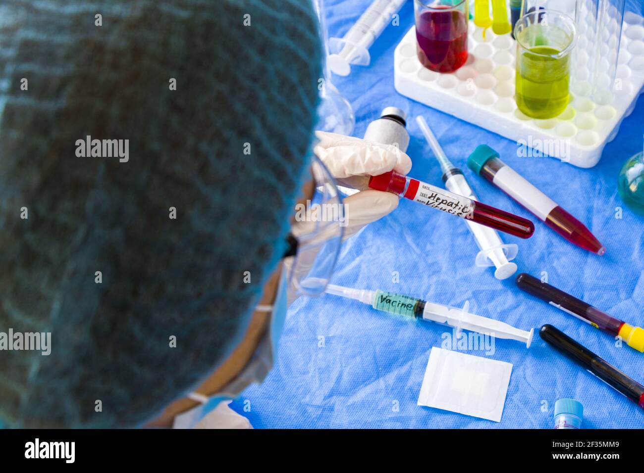 A Doctor Holding A Hepatic Blood Test Tube Sample In A Laboratory Stock Photo Alamy