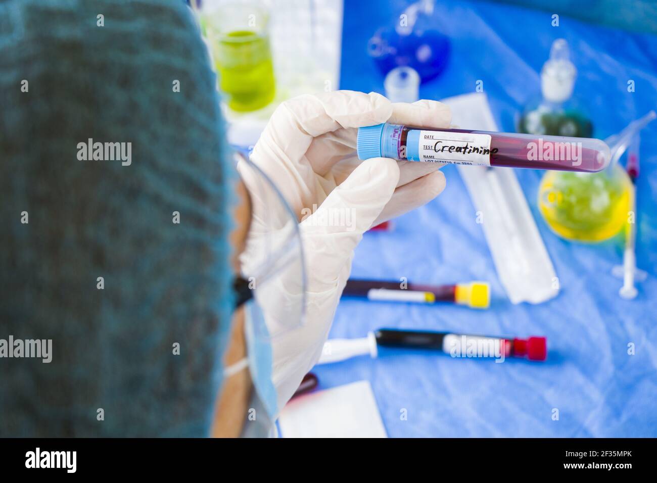 A doctor holding a creatinine blood test tube sample in a laboratory
