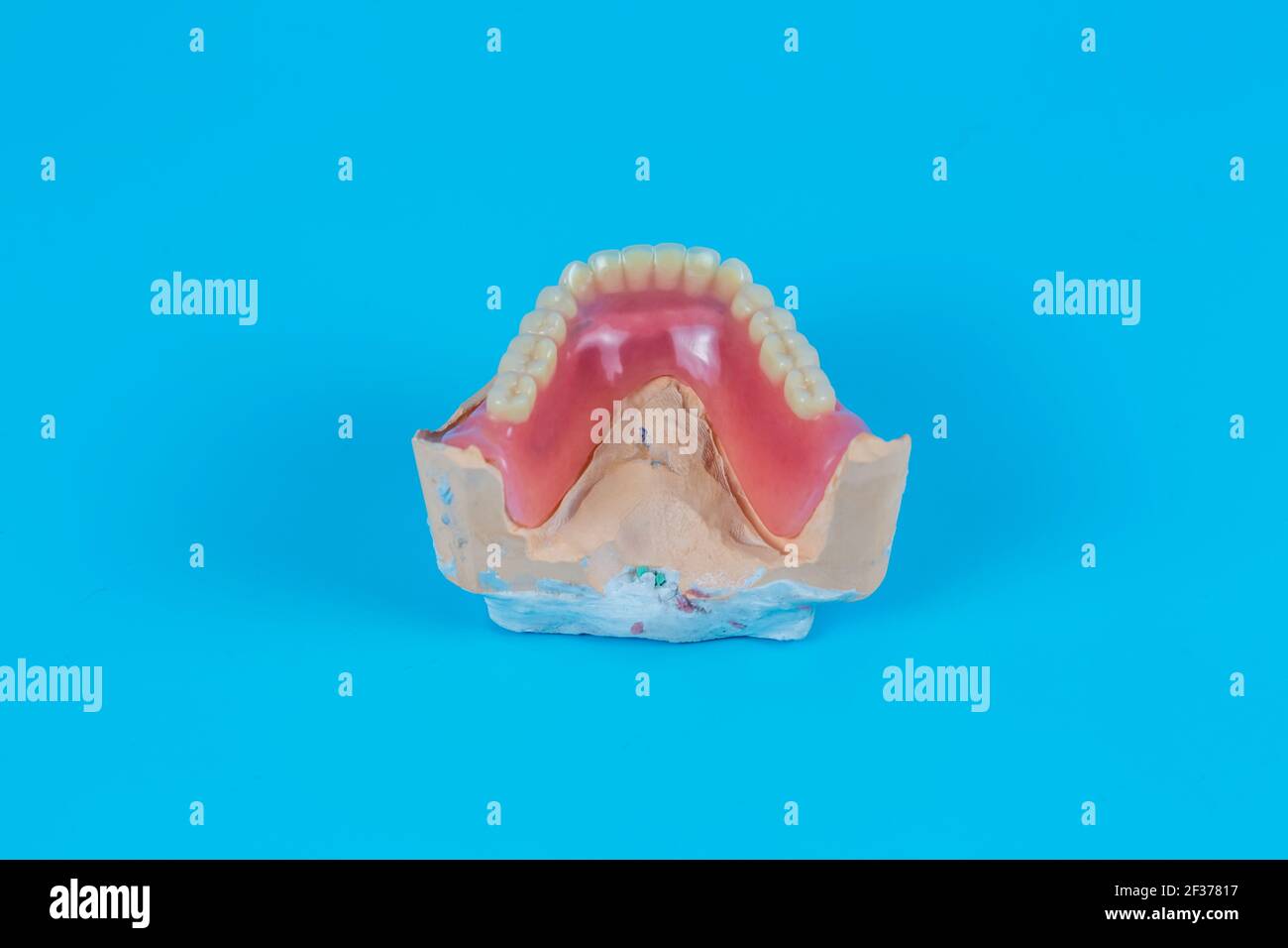 Plaster mock-up of the jaw with gums and teeth on a blue background ...