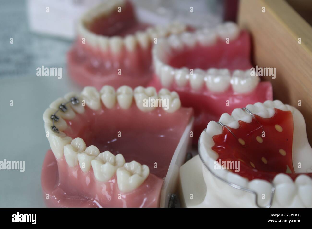 Different types of dental models hires stock photography and images